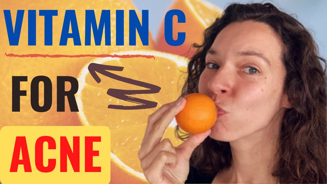 Does VITAMIN C Help For ACNE? Vitamin C and Acne Scars Vitamin C in