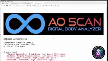 AO Scan Using the DataBase and Reports