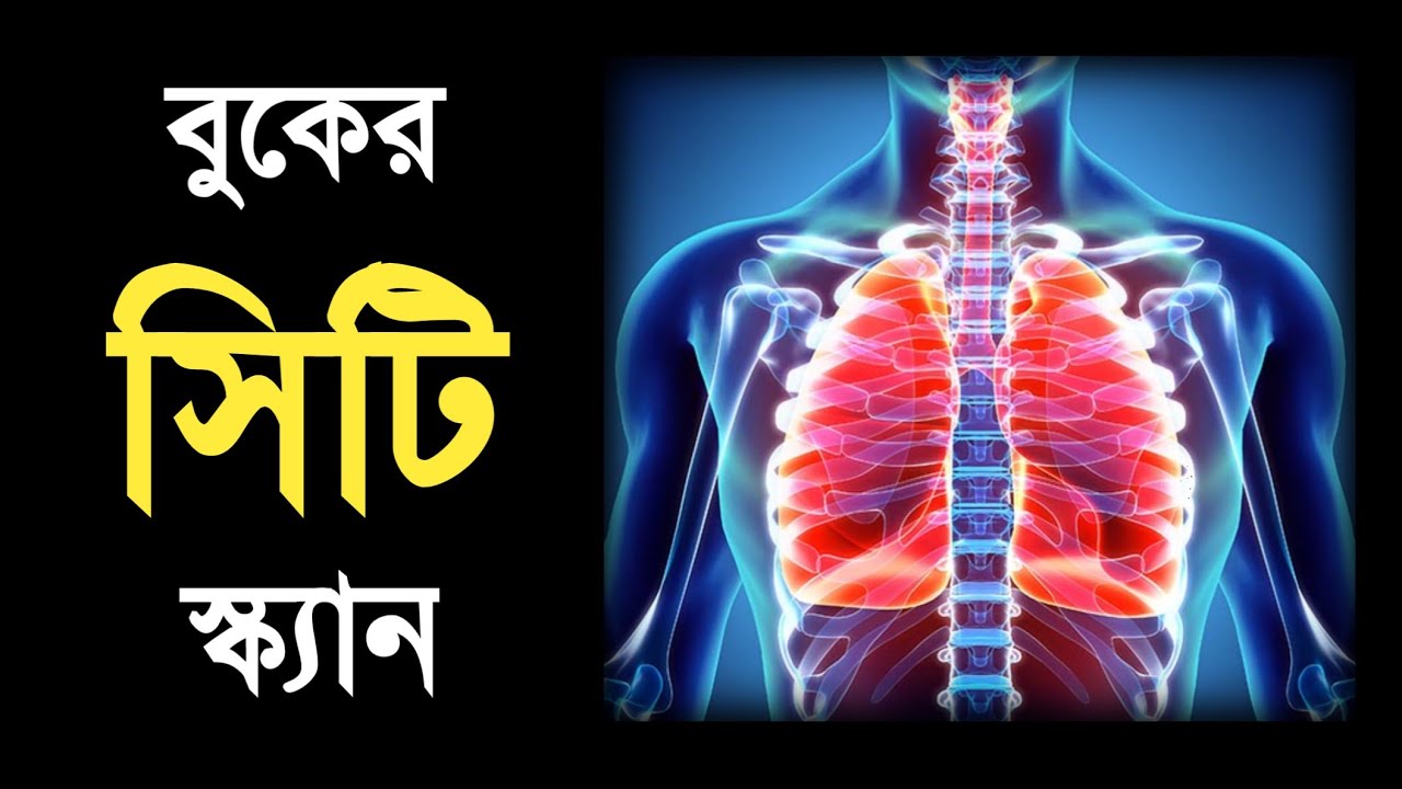 বুকের সিটি স্ক্যান পরীক্ষা । CT Scan of Chest in Bangla YouTube