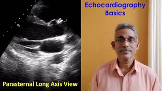 Echocardiography Basics