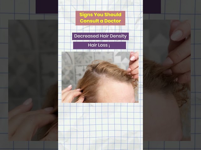 Hair Fall | Hair Analysis | Hair Care | Hair Problem | Dr Sunil Kohtiwala