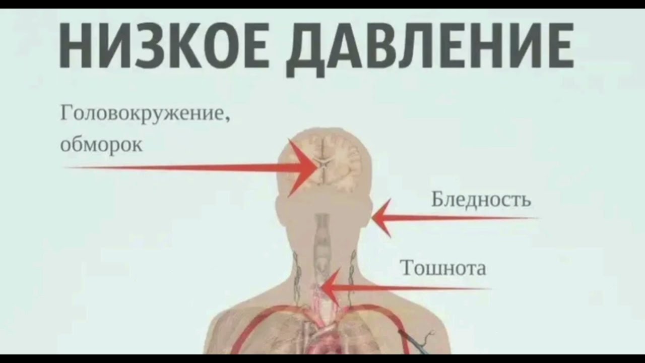 При высоком давлении кружится голова. Что повышает давление. Что повышает давление в домашних. Как поднять давление. Поднять давление в домашних.