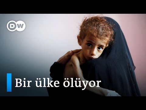 Yemen’de 400 bin çocuk açlıktan ölüm tehlikesiyle karşı karşıya - DW Türkçe