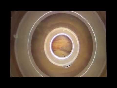 Reparación de hernia inguinal laparoscópica, abordaje complétamente extraperitoneal. TEP