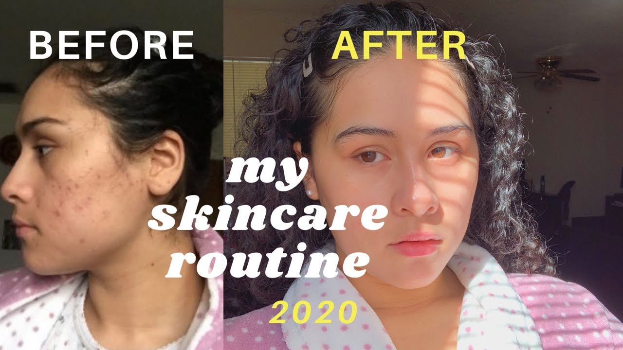 how i cleared my skin ~ 2020 skincare routine - YouTube