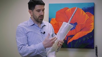 How A Custom AFO Is Made Part 3: Removing The Fiberglass Cast