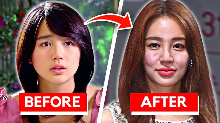 Korean Actors Who RUINED Their Face With Too Much Plastic Surgery - DayDayNews