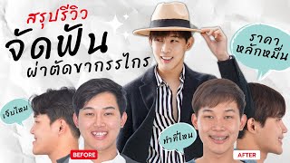 [สรุปรีวิว] รายละเอียดครบ...ทุกขั้นตอนจบในคลิปเดียว! เริ่มต้น-สิ้นสุด? l จัดฟันร่วมกับผ่าตัดขากรรไกร