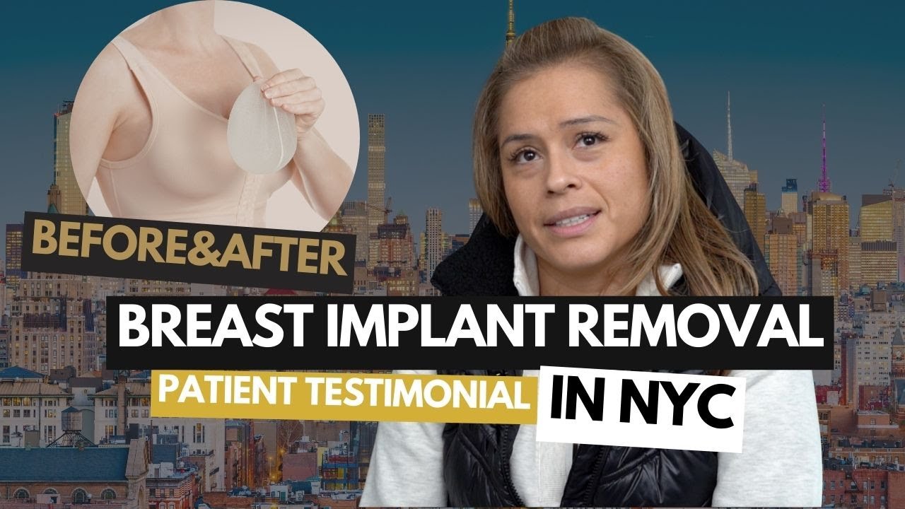 Breast Implant Removal in New York City | Honest Explant Surgery Experience