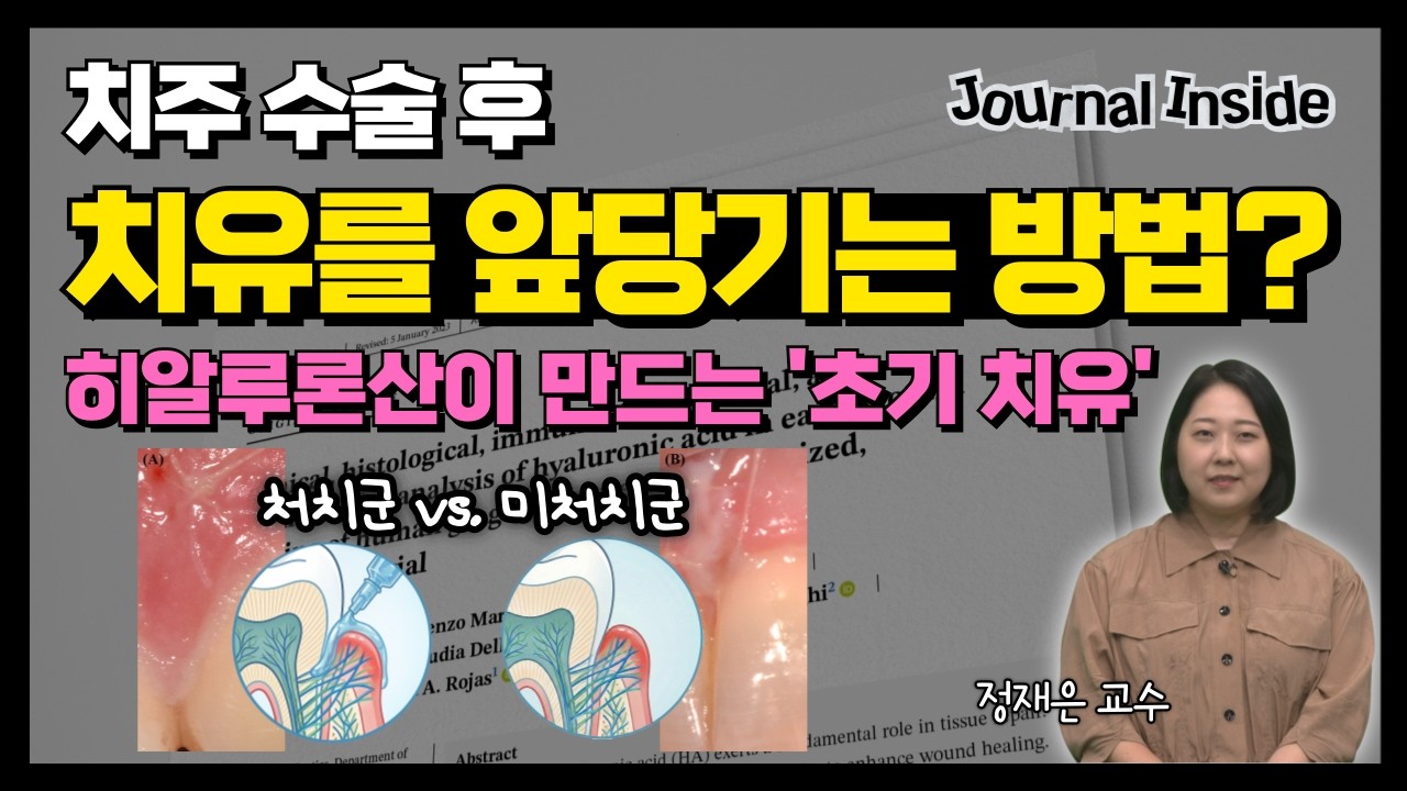 [Journal Inside] 치주 수술 후 히알루론산, 치유에 효과가 있다?! 히알루론산 처치군 vs. 미처치군 임상 결과 비교
