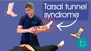 Tarsal Tunnel Syndrome - Everything You Need To Know