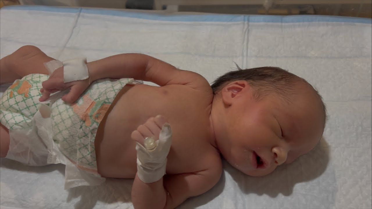 Dolichocephalic Baby Head Shape Explained | Is It Normal? | Neonatal Care Guide