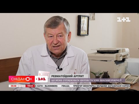 Які фактори ризику артриту та як на нього впливає коронавірус