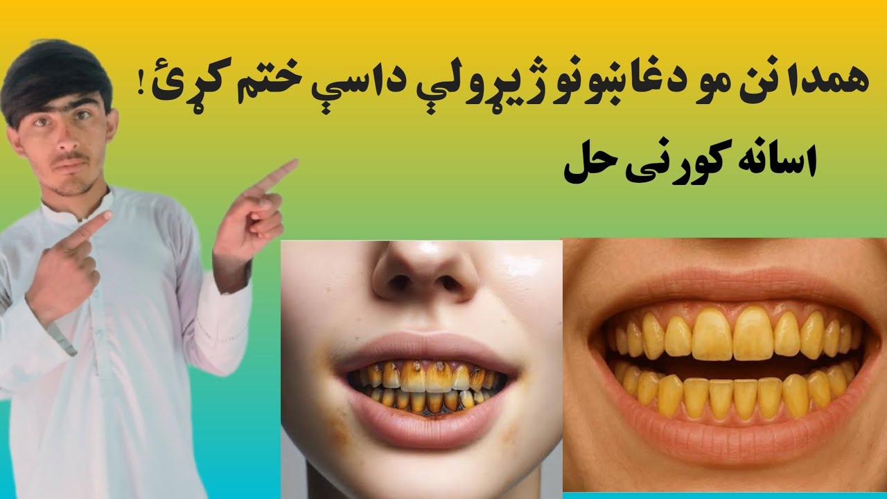 دغاښونو دژيړوالې محنيوی-اسانه اواعيزمنې لارې!