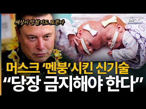 '머스크가 두려워하는 기술 1위'.. 몸에서 '이것' 갈아 끼우니 다시 젊어졌다;;