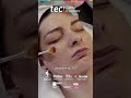 Peeling moyen : clés pour des résultats cliniques sûrs ❘ TECH Global University
