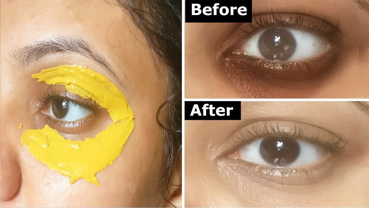 Applying Turmeric Around The Eyes In 10 Minutes and See What Will