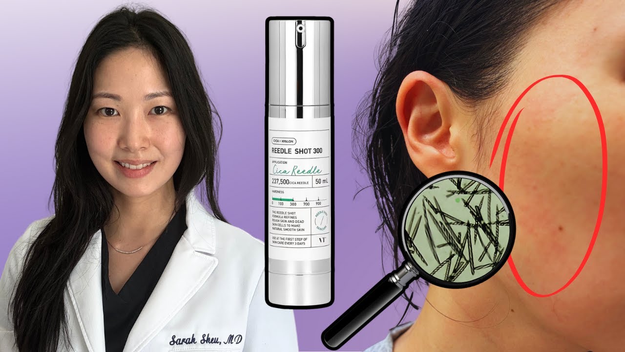 Microneedling Creams are a Scam (Dermatologist)