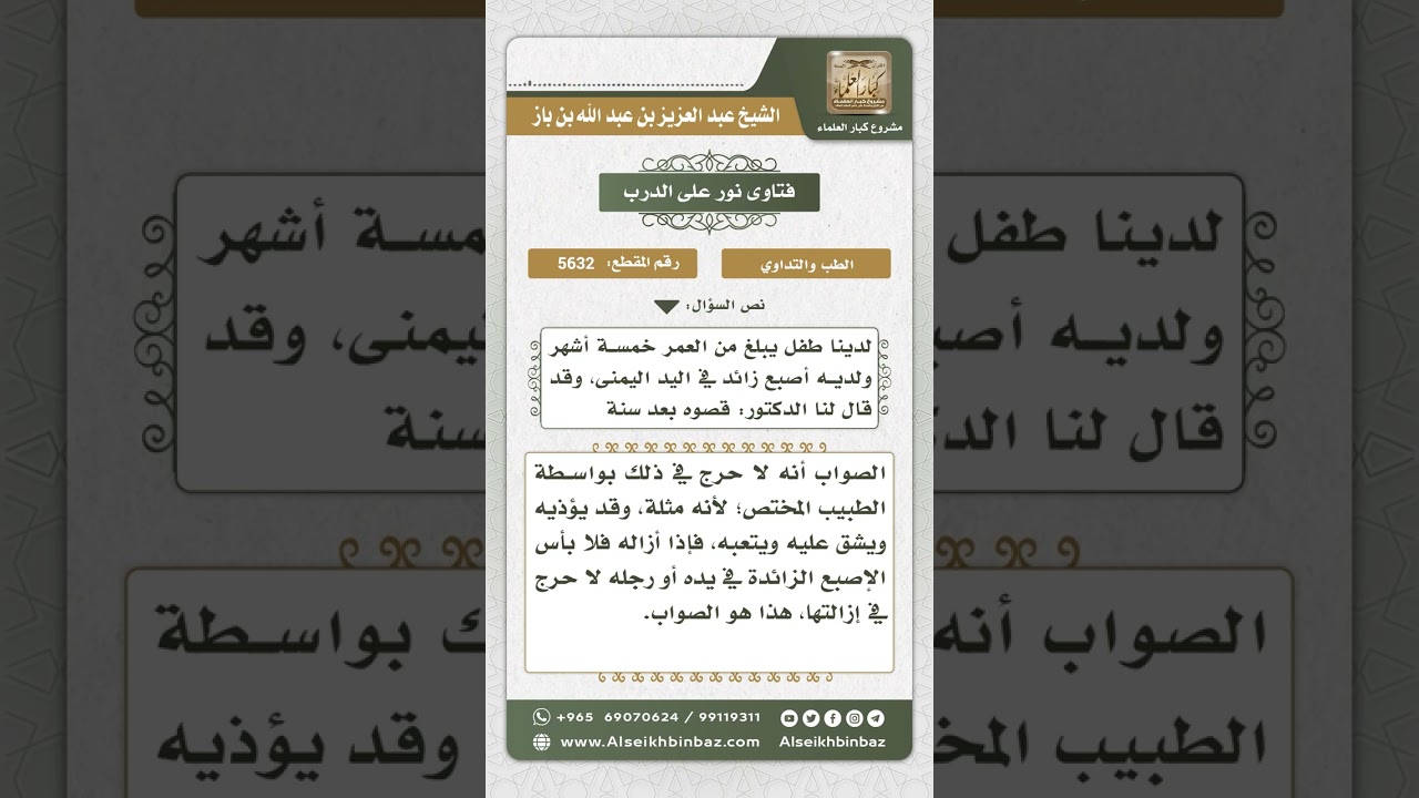 5632 - حكم قطع الأصبع الزائدة في اليد - نور على الدرب