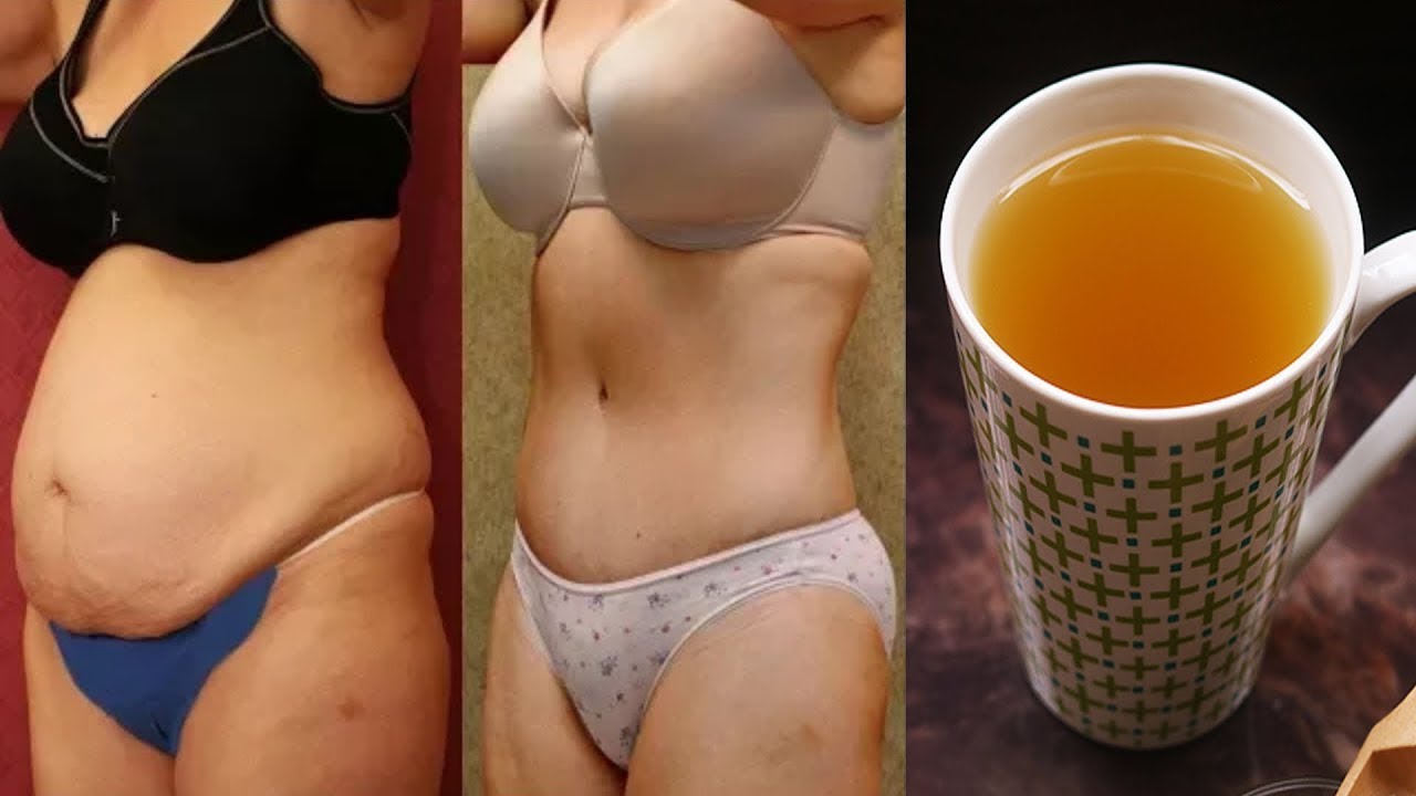 STRONGEST BELLY FAT BURNER DRINK LOSE 15KG 30LBS IN 2 WEEKS YouTube