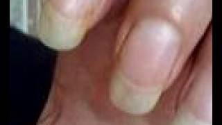 Feti shows off his nails