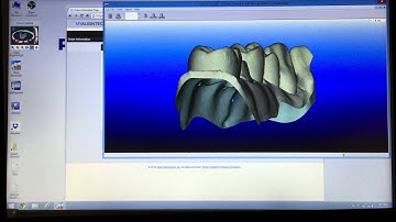 Exporting an iTero Scan