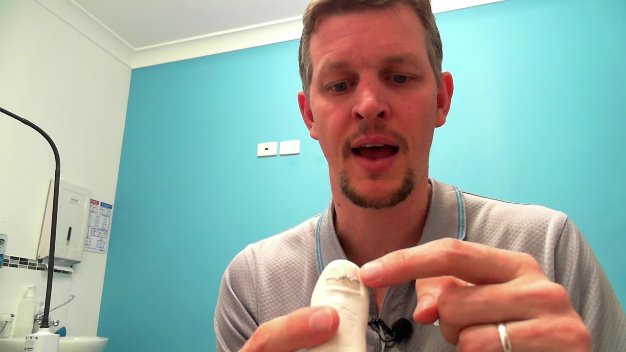 Ingrown Toe Nail Myths YouTube ingrown-toe-nail-myths-youtube