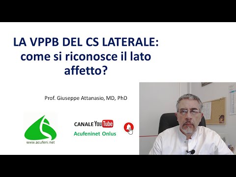 VPPB del CS laterale