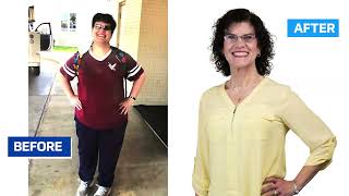 Food No Longer Controls My Life, I Do | Rebecca Wilson Bariatric Weight-Loss Surgery Testimonial
