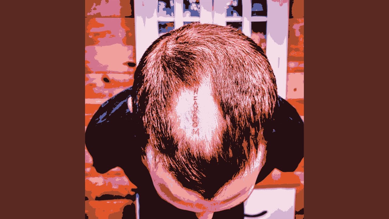 Watch Baldspot on YouTube Watch Baldspot on YouTube