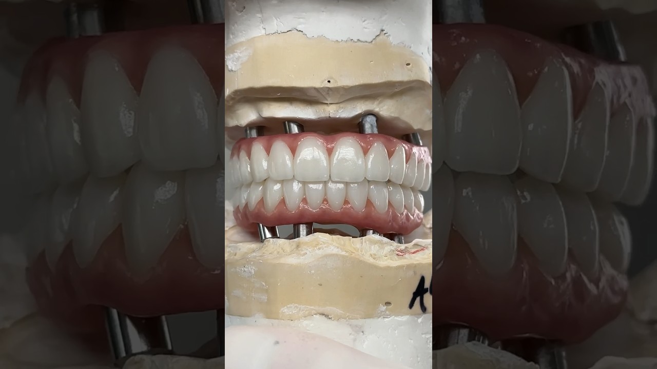 preview_player