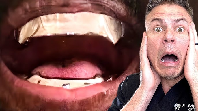 Orthodontist Reacts! ASMR Braces! 