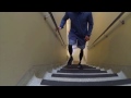 Bilateral Above Knee Amputee Climbing Stairs