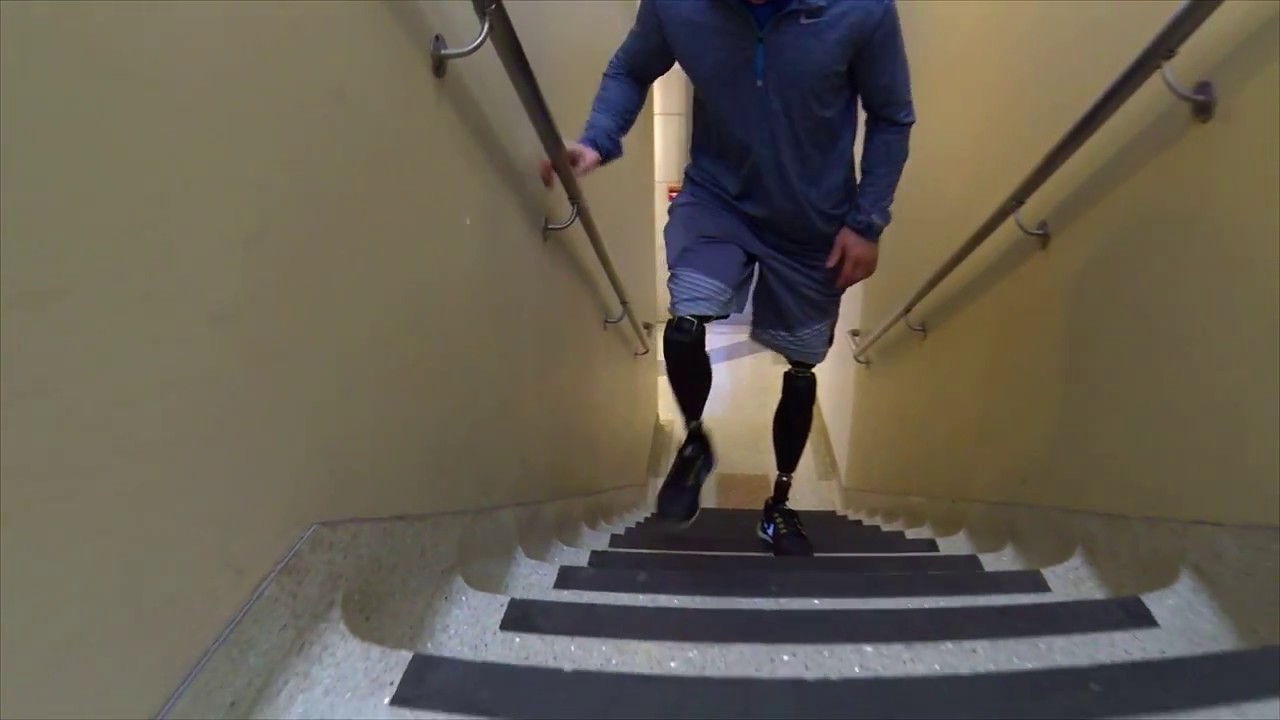 Bilateral Above Knee Amputee Climbing Stairs YouTube