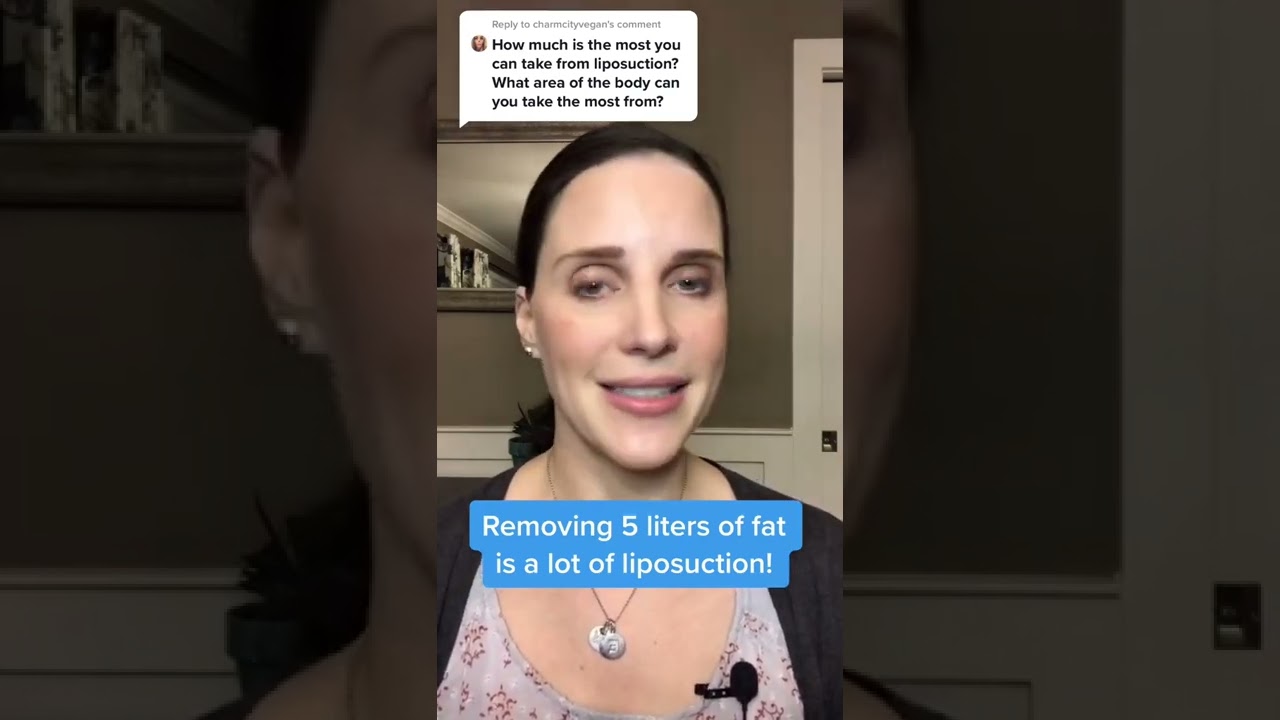 How Much Fat Can Liposuction Eliminate? | Greer Plastic Surgery