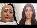 My facial feminization surgery story  gia gunn