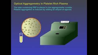 Optical Aggregation in Platelet-Rich-Plasma
