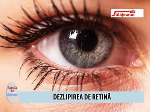 Dezlipire de retina