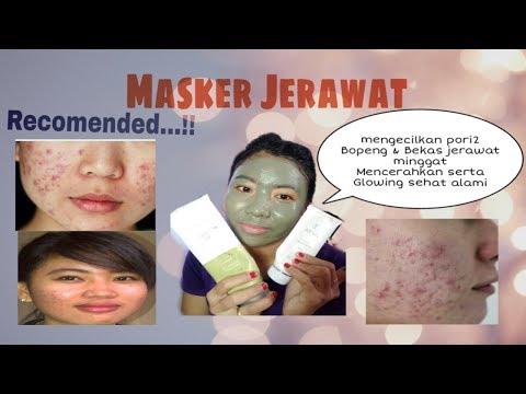 Video: Cara Menggunakan Multani Mitti Untuk Jerawat