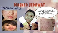 Cara menghilangkan jerawat, MASKER TERAMPUH PENGHILANG JERAWAT | Obat Jerawat - Durasi: 6.48. 