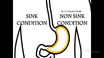 Sink Condition & Non sink Condition