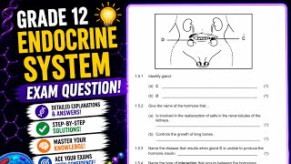 Grade 12 Endocrine System Exam Question| Homeostasis| Life Science| Past paper