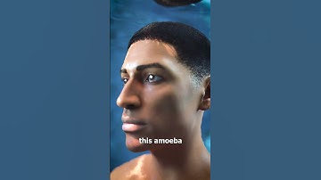 Brain Eating Amoeba 😱(Explained)