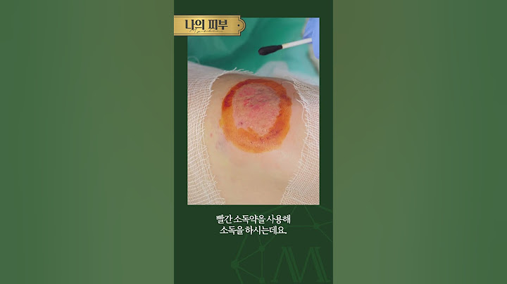다쳤을 때 ❌소독 함부로 하시면 안 됩니다!❌ #Shorts