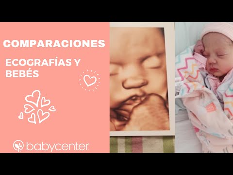 Comparaciones de ecografías y bebés