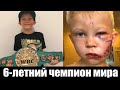 6-летний Мальчик Спас Свою Сестру от Собаки