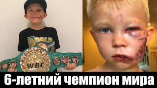 6-летний Мальчик Спас Свою Сестру от Собаки