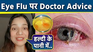 Eye Flu Ayurvedic Treatment | Eye Flu Home Treatment In Hindi | Eye Flu Hone Par Kya Karen | Boldsky