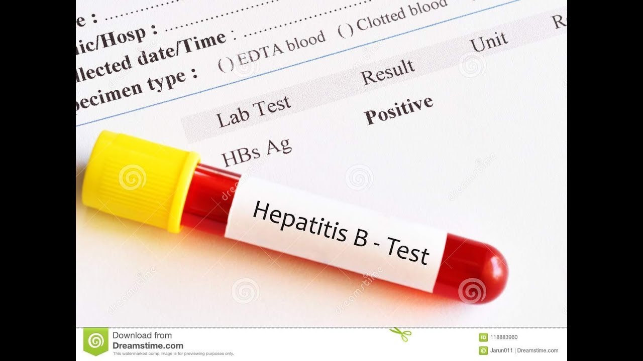 TERNYATA INI PENYEBAB HEPATITIS B PADA IBU HAMIL YANG SAMA DENGAN