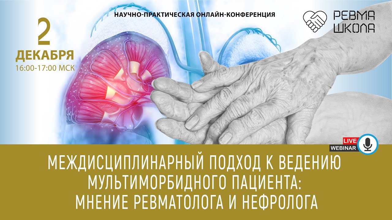 Применение междисциплинарного подхода в лечении пациентов с хронической подагрой